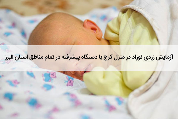 آزمایش زردی نوزاد در منزل کرج